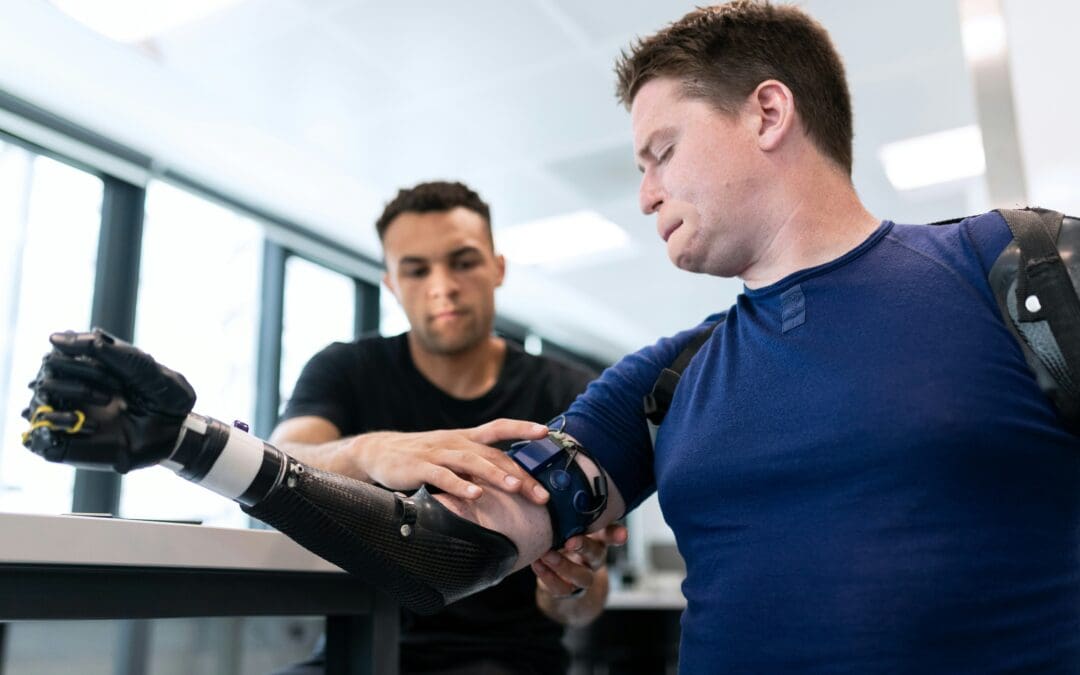 ProstheticAI